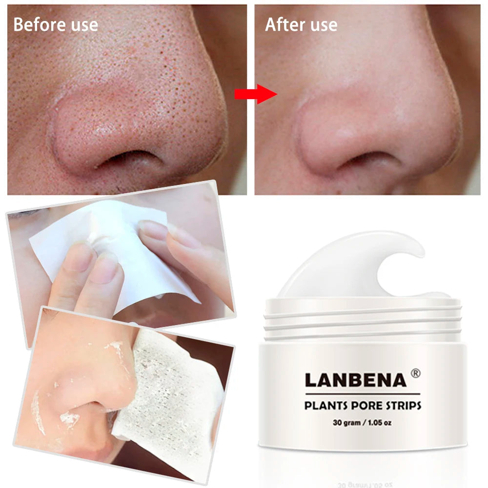 Blackhead Remover Nose